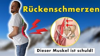 Rückenschmerzen sind kein Bandscheibenvorfall  Ursache amp Lösung durch Übungen [upl. by Flora]