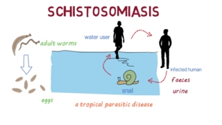 Schistosomiasis Bilharzia– an overview [upl. by Golding]