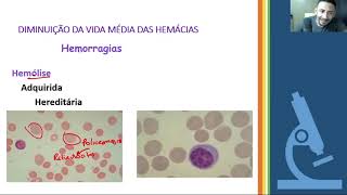 Interpretação do Hemograma  Fisiopatologia das Anemias [upl. by Evadne340]