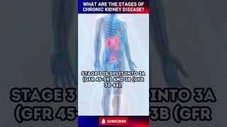 What are the Stages of Chronic Kidney Disease shorts [upl. by Adnahsor715]