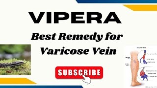 VIPERA  A GREAT REMEDY FOR VARICOSE VEIN  HOMOEOPATHY [upl. by Aihpos980]