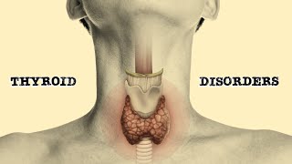 Thyroid Disorders [upl. by Diena]