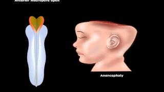 USMLE® Step 1 Neuroscience Development of CNS Animation [upl. by Camm150]