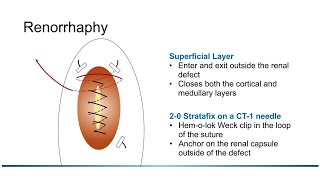 Renorrhaphy After Partial Nephrectomy Considerations and Planning Part 1 [upl. by Bobbi741]