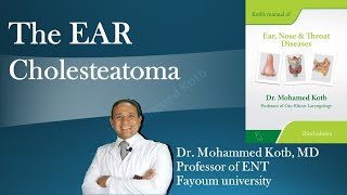 The ear diseases chronic ear infection cholesteatoma Professor Dr Qotb [upl. by Ane]