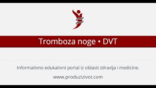 Tromboza noge • DVT duboka venska tromboza [upl. by Ahse]