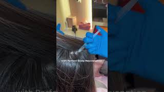 Perfect Scalp Rejuvenation  Korean Scalp Treatment in KL  Perfect Doc [upl. by Nnaid]