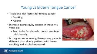 Genome imaging of head and neck solid tumors oropharyngeal tongue and thyroid cancers [upl. by Yrreb]