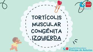 Tortícolis muscular congénita izquierda [upl. by Nade877]