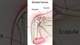 Anatomy radiologyfacts shoulderfiger short [upl. by Ettie]