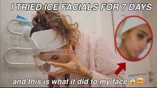 I Tried Ice Facials For 7 Days amp This Happened…  Does it actually work 🧊❄️ [upl. by Narod]