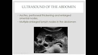 Radiologic features of mesenteric and omental pathologies [upl. by Gnem]