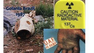 the Goiania Cesium 137 radiological accident [upl. by Ahsienauq]