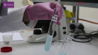 General Biology Lab  Enzymes effect of amylase on starch [upl. by Raven894]