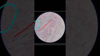 White Fibrocartilage Histology Anatomy 1st year MBBS [upl. by Pineda]