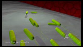 What Are Bacterial Biofilms A Six Minute Montage [upl. by Ttenaej]