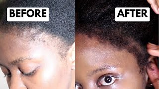 EDGES  HAIRLINE RECOVERY  8 TIPS on how I’m doing it  South African YouTuber [upl. by Yatnod]