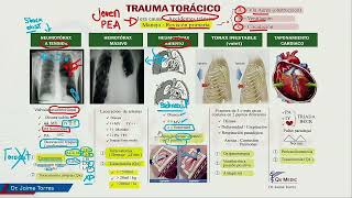 Mapas mentales  Trauma torácico [upl. by Nadabas]