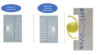 How Diffractive Multifocal IOLs work [upl. by Loyce979]