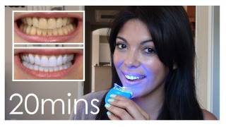 How to get white teeth fast  just 20 mins [upl. by Gilba]