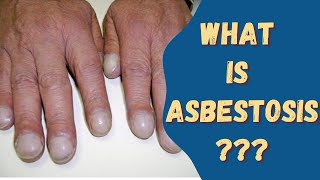 Asbestosis Asbestos disease Sign amp Symptoms Causes and risks [upl. by Eissat]