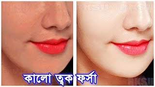 ফর্সা হওয়ার উপায় Forsha Howar Tips  Rupchorcha  Skin Whitening Home Remedies For Fair Skin [upl. by Htevi375]