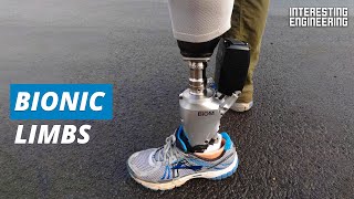 Bionics are the future of prosthetics [upl. by Tigdirb]