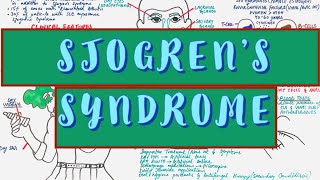 Sjogrens Syndrome  Causes Clinical features Diagnosis amp Treatment [upl. by Manwell606]