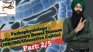 Pathophysiology of Inflamatory Bowel Disease IBDUlcerative Colitis What is IBS Part 25 [upl. by Kern]