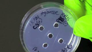 How To Perform An Ouchterlony Assay Double Immunodiffusion Assay [upl. by Annawahs]