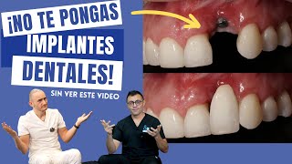 ¡No te pongas un Implante Dental sin ver este video [upl. by Yeltnerb]