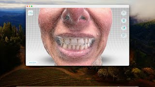 How to get a detailed 3D mesh in Qlone Face Scans for Dental CADCAM [upl. by Nero]