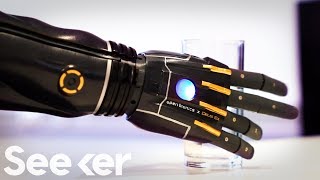 Engineers Created A New Bionic Arm That Can Grow With You [upl. by Helbonnas]