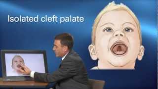 Cleft Treatment  Pediatric Playbook  Boston Childrens Hospital [upl. by Keele830]