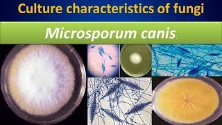 Microsporum canisculture characteristics of fungi [upl. by Agarhs]