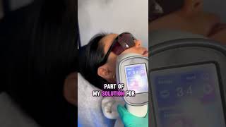 Does laser hair work LaserHairRemoval Acne Facials DarkSkin NearMe ForYouPage FYP spa [upl. by Wolfram576]