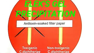 Eleks gel precipitation test in hindi [upl. by Tenaj]