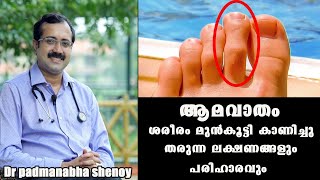 ഈ ലക്ഷണം നിങ്ങൾക്കുണ്ടോ ശ്രദ്ധിക്കുക Dr Padmanabha shenoy RheumatismBaijus Vlogs [upl. by Pandora]