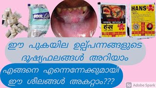 Smoklesstobacco Tobacco pouch keratosis Explained in malayalam  Dr Anagha Cheleri [upl. by Denni]