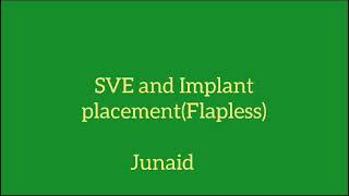 SVE and Implant placement Flapless  Dr Junaid S M H [upl. by Noslrac]