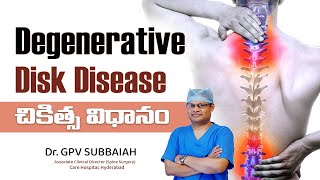 How is degenerative disk disease treated  Degenerative Disk Disease  Health video Dr GPV Subbaiah [upl. by Fawna]