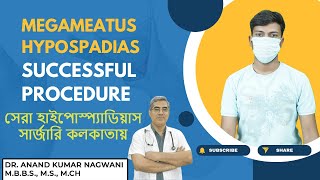 Best HYPOSPADIAS Surgery in Kolkata  MEGAMEATUS Hypospadias Surgery in Kolkata   By COSMO AID [upl. by Lieno10]