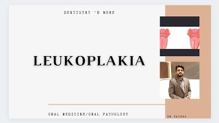 LEUKOPLAKIA [upl. by Silberman431]