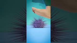 How To Remove Sea Urchin Spines 😬  Melon Playground urchin [upl. by Mohkos771]