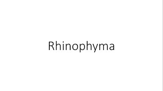 Rhinophyma  ENT [upl. by Airom]