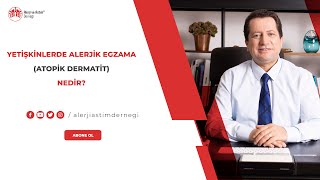 Yetişkinlerde alerjik egzama atopik dermatit nedir [upl. by Reivaj]