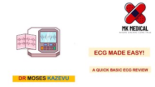 ECG made easy [upl. by Mayes]