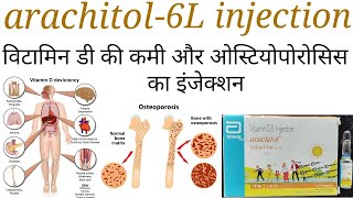 Arachitol 6L injectioncholecalciferol 600000iuvitamin d3 injection ke fayde upyog in hindi [upl. by Joelle917]