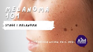 What is Stage I Melanoma [upl. by Amalbergas]