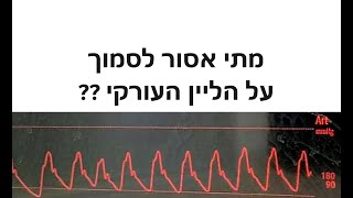 האם אפשר לסמוך על הליין העורקי [upl. by Bigford]